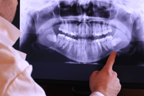 Best Emergency Treatment for Oral Infections in Flossmoor, IL