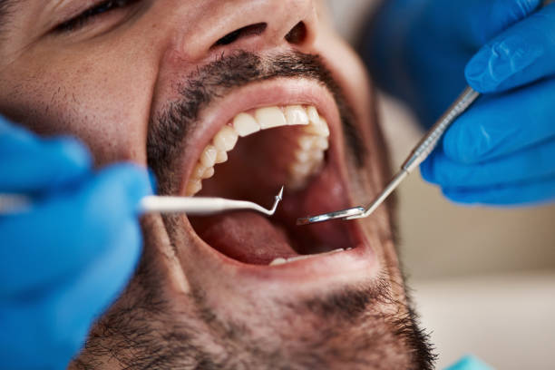 Best Dental Abscess Treatment in Flossmoor, IL